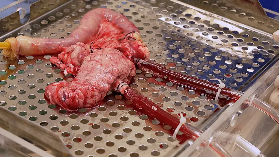 Normothermic <em>Ex Vivo</em> Pancreas Perfusion for the Preservation of Pancreas Allografts before Transplantation
