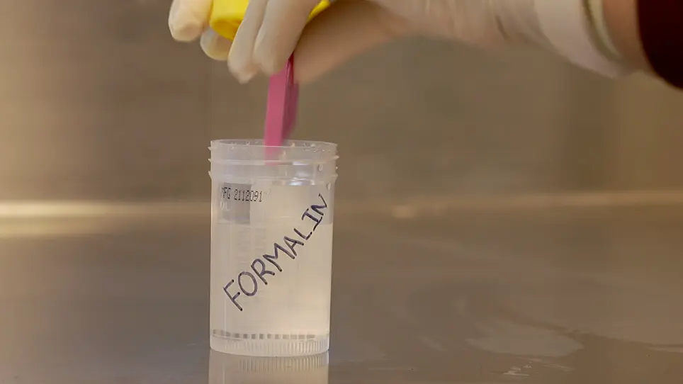 Surgical Tips and Tricks for Performing Porcine Pancreas Transplantation