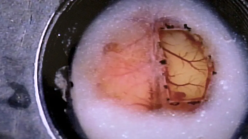 <em>In Vivo</em> Wide-Field and Two-Photon Calcium Imaging from a Mouse Using a Large Cranial Window