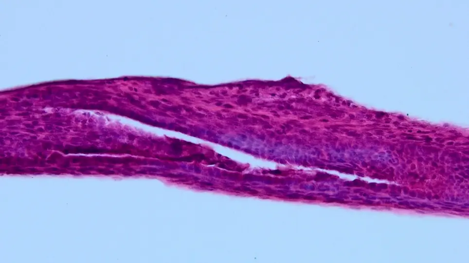 Extrahepatic Bile Duct and Gall Bladder Dissection in Nine-Day-Old Mouse Neonates