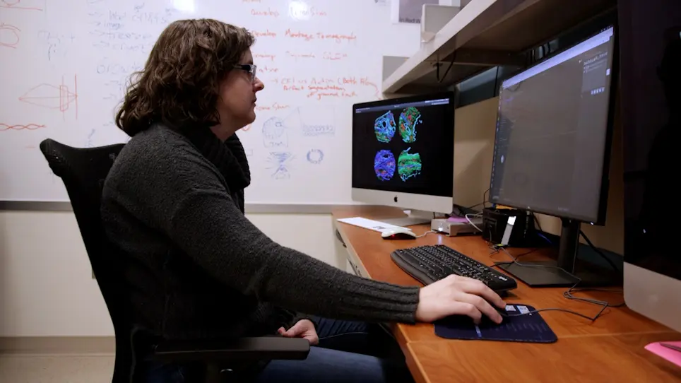 Deep Learning-Based Segmentation of Cryo-Electron Tomograms