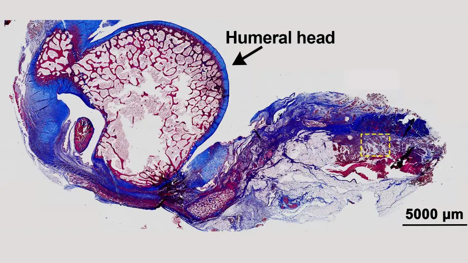 Development of a Rabbit Chronic-Like Rotator Cuff Injury Model for Study of Fibrosis and Muscular Fatty Degeneration