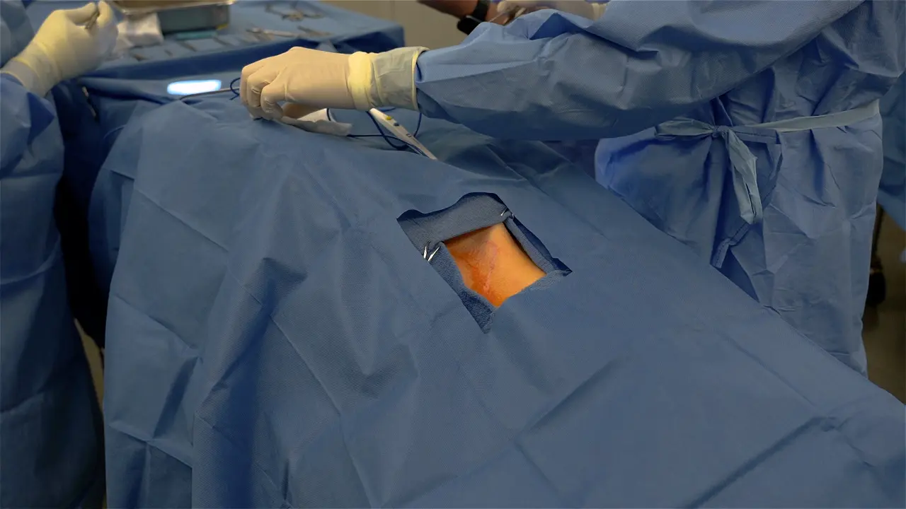 Hickman Catheter Use for Long-Term Vascular Access in a Preclinical Swine Model