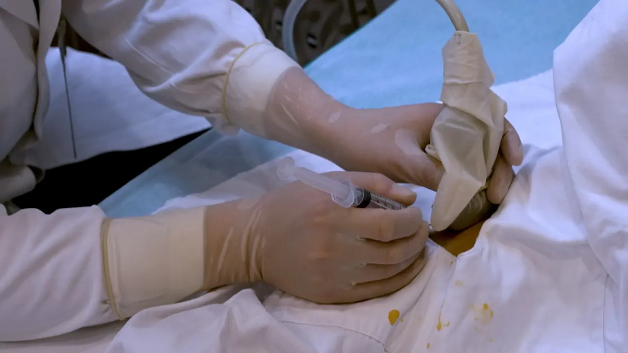 Ultrasound-Guided Needle Release Combined with Corticosteroid Injection for the Treatment of Supinator Syndrome