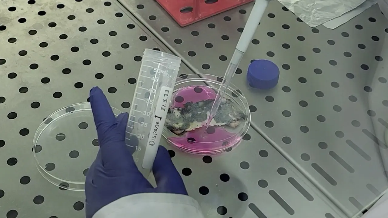 Murine Dermal Lymphatic Endothelial Cell Isolation