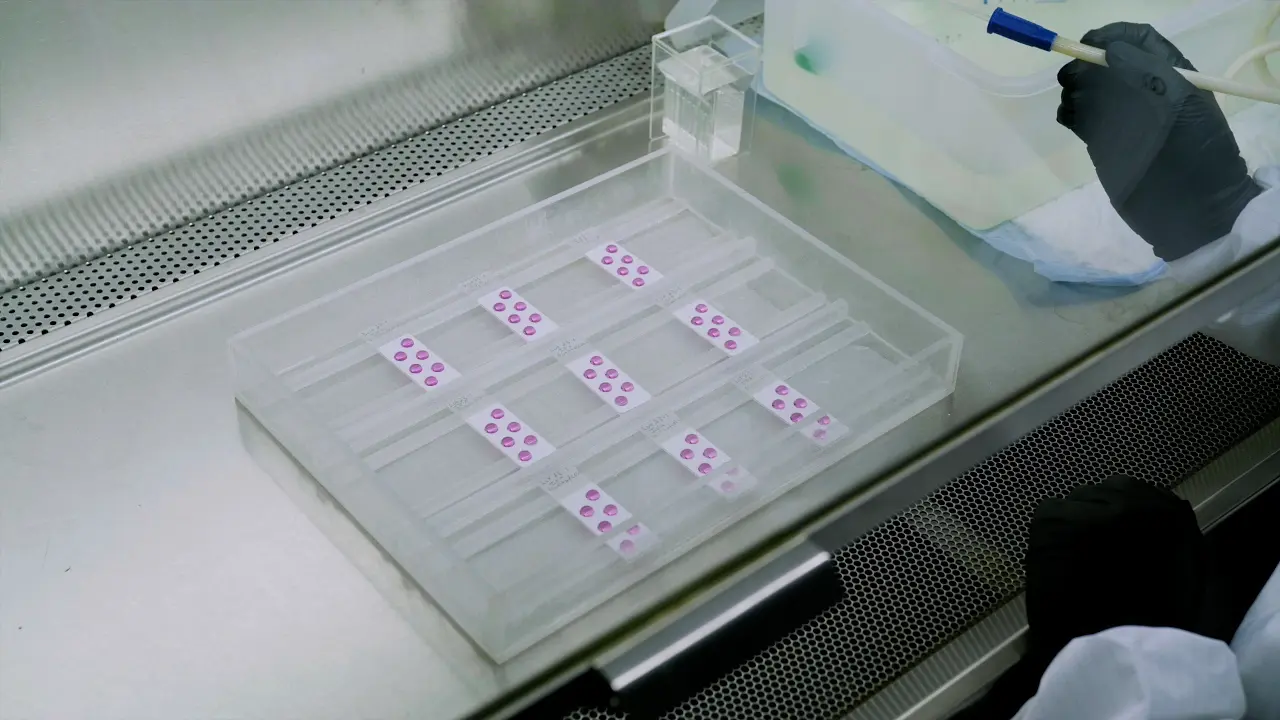 Detection of Rabies IgG and IgM Antibodies Using the Rabies Indirect Fluorescent Antibody Test
