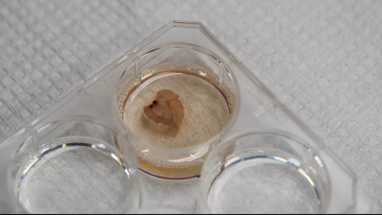 Decellularization-Based Quantification of Skeletal Muscle Fatty Infiltration