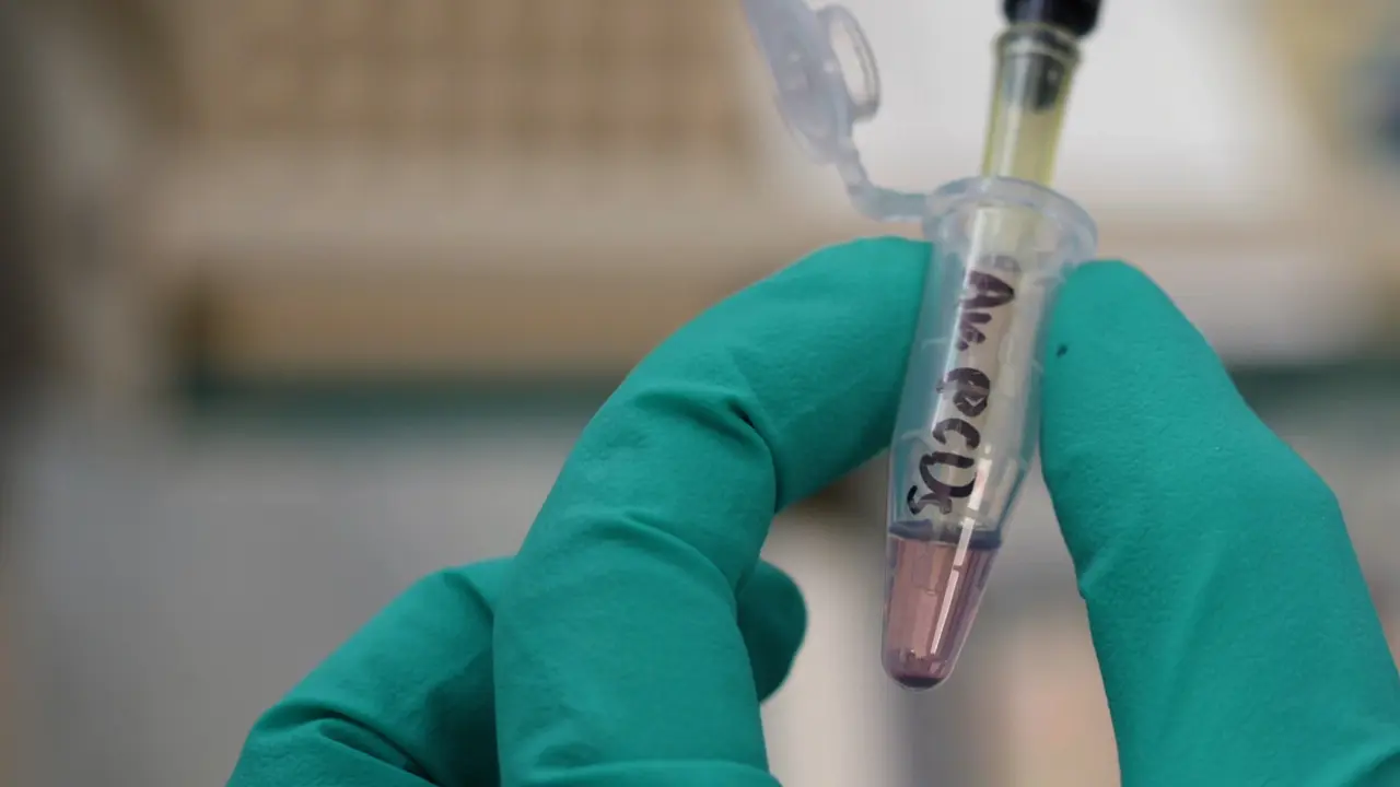Label-Free Surface-Enhanced Raman Scattering Bioanalysis Based on Au@Carbon Dot Nanoprobes