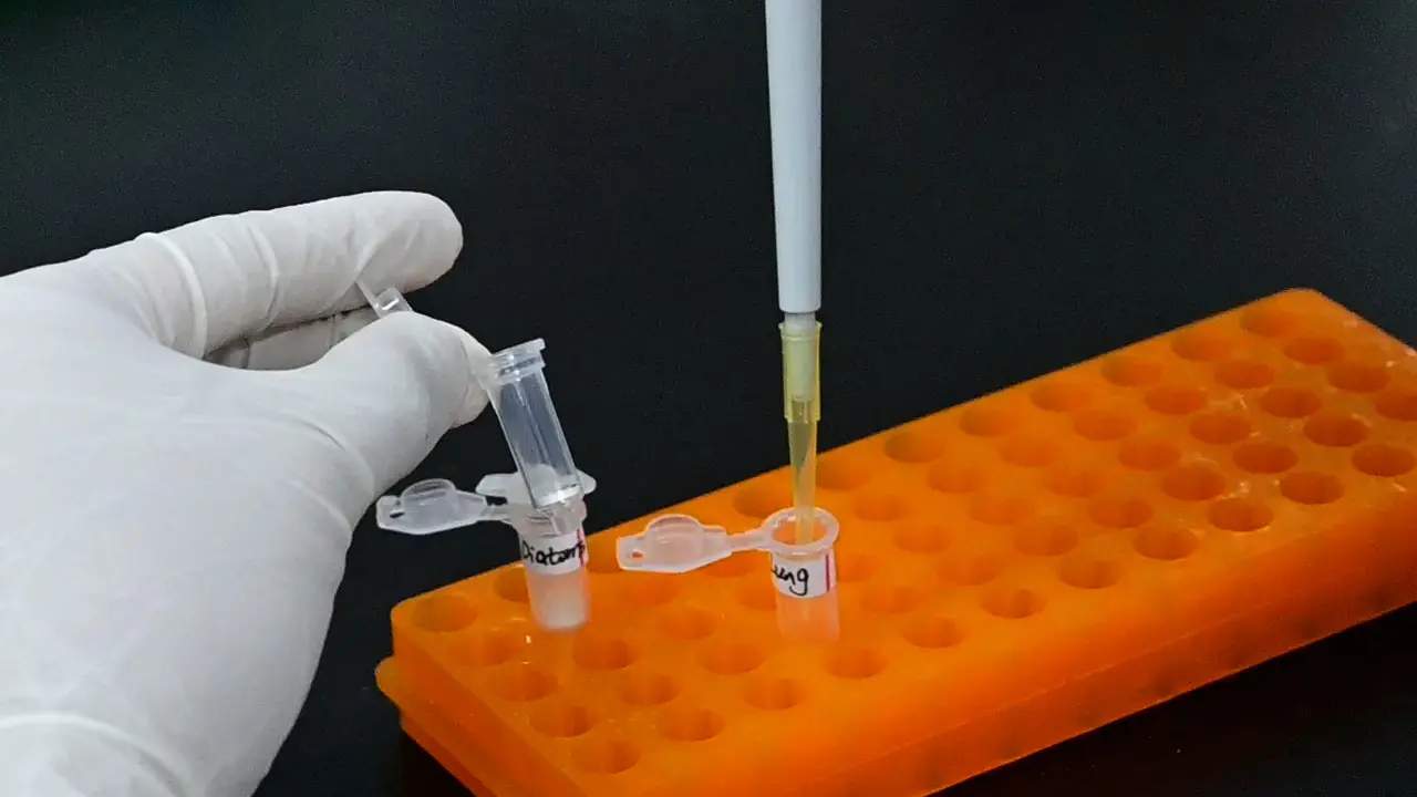 Extraction of Diatom DNA from Water Samples and Tissues
