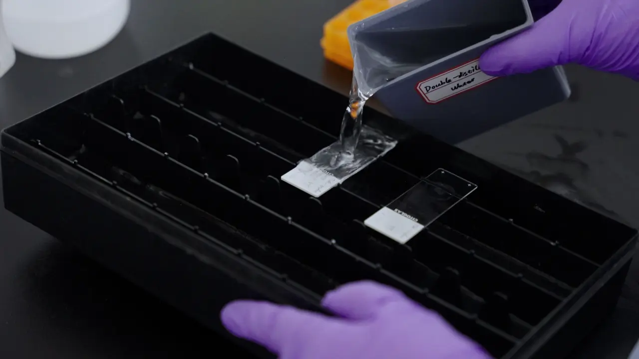 Multiplex Immunohistochemistry Staining for Paraffin-embedded Lung Cancer Tissue