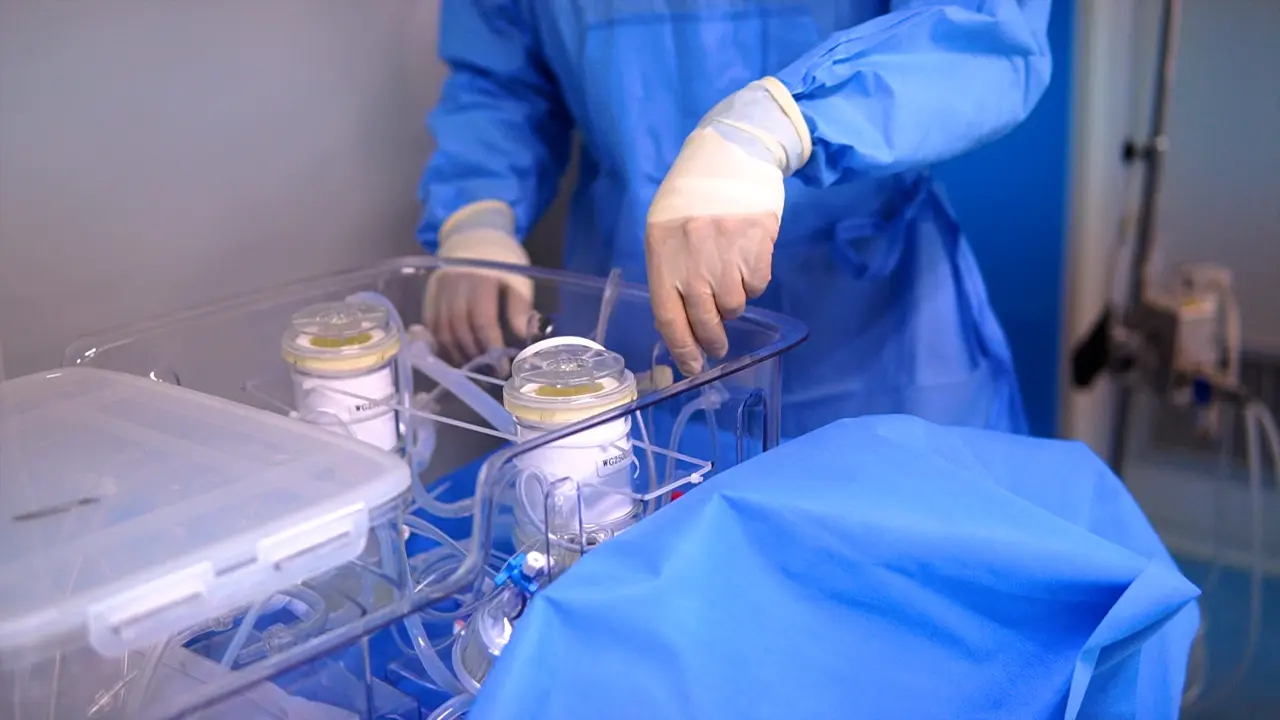 Preservation of Porcine Donation after Circulatory Death (DCD) Liver by Perfusion and Orthotopic Liver Transplantation