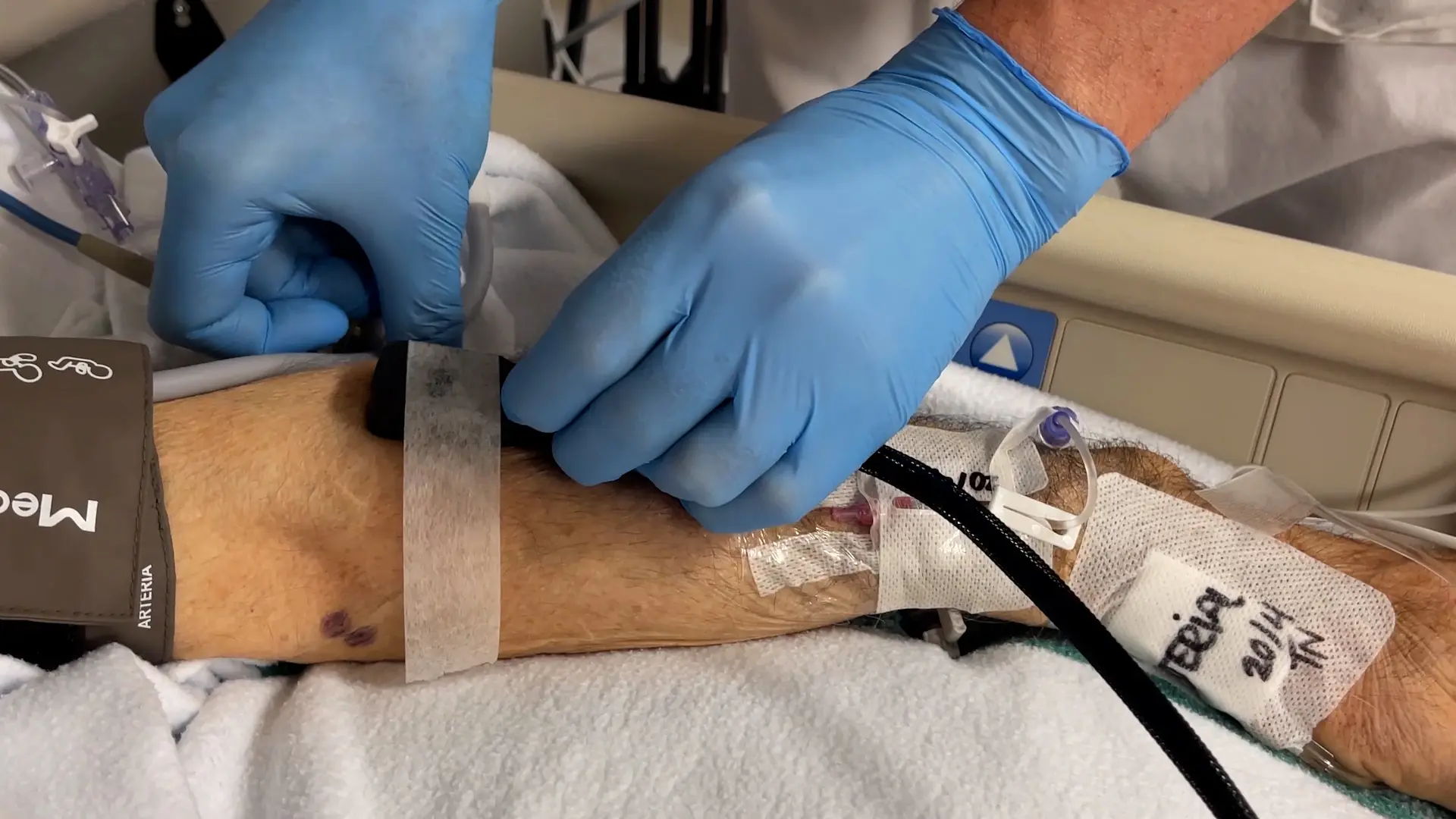 Non-Invasive Monitoring of Microvascular Oxygenation and Reactive Hyperemia using Hybrid, Near-Infrared Diffuse Optical Spectroscopy for Critical Care