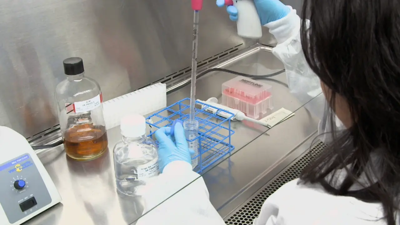 Quantification of <i>Acanthamoeba</i> spp. Motility