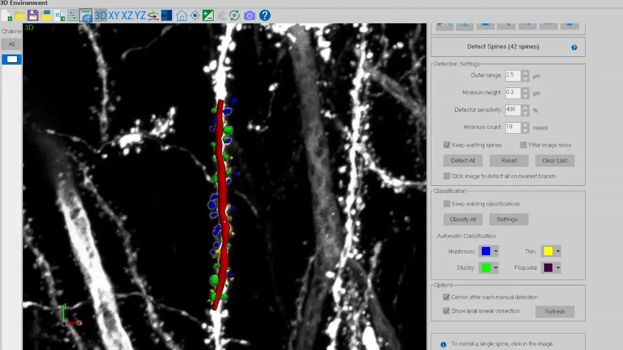 Dendritic Spine Quantification Using an Automatic Three-Dimensional Neuron Reconstruction Software