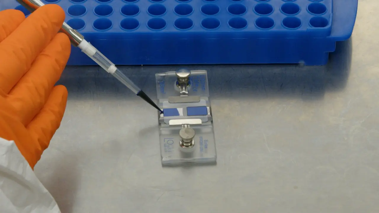 Production of High-Yield Adeno Associated Vector Batches Using HEK293 Suspension Cells