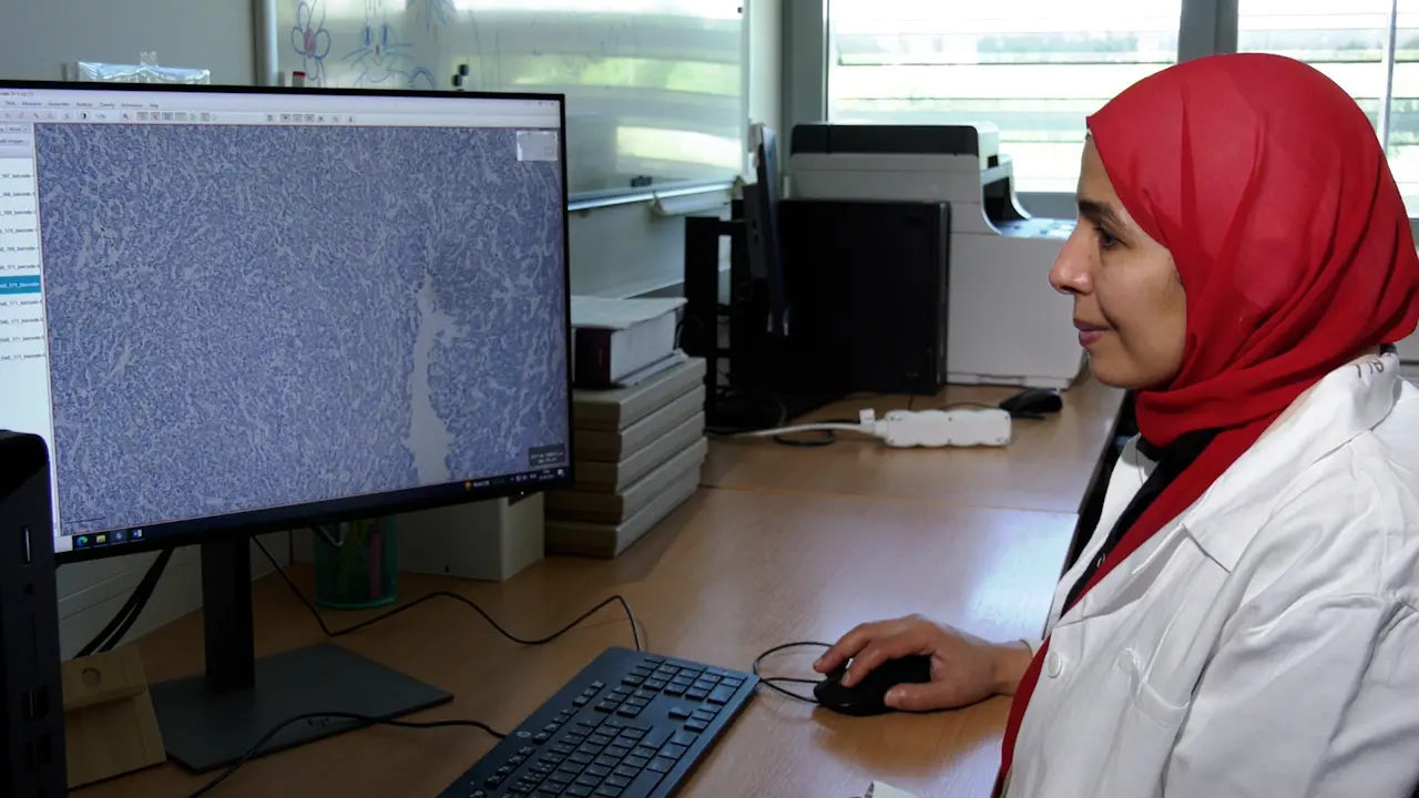 Mast Cells in the Microenvironment of Hepatocellular Carcinoma Confer Favorable Prognosis: A Retrospective Study using QuPath Image Analysis Software
