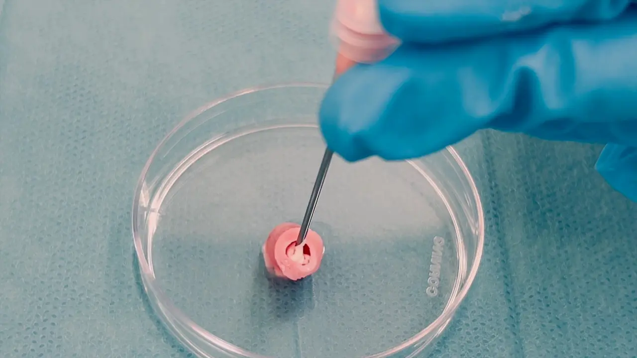 Comprehensive Characterization of Tissue Mineralization in an Ex Vivo Model