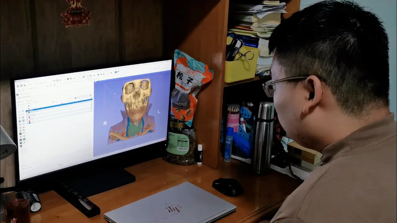 Mixed Reality Assisted Radical Endoscopic Thyroidectomy