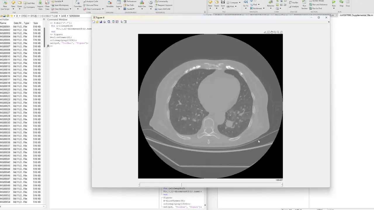 Multifractal Spectrum Analysis for Assessing Pulmonary Nodule Malignancy