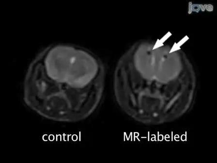 Labeling hESCs and hMSCs with Iron Oxide Nanoparticles for Non-Invasive in vivo Tracking with MR Imaging