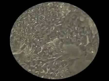 From MEFs to Matrigel I: Passaging hESCs in the Presence of MEFs
