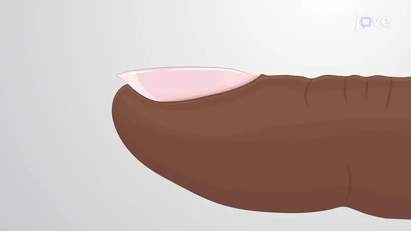 皮膚のアクセサリー構造:爪
