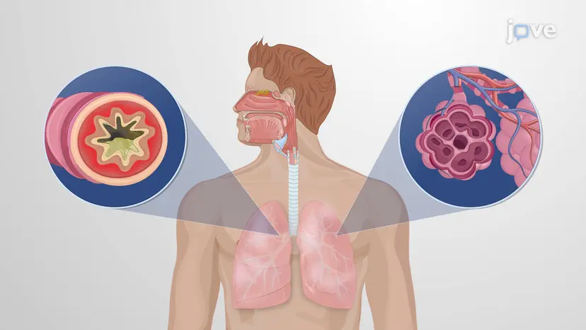 下気道疾患に使用される薬剤: 概要