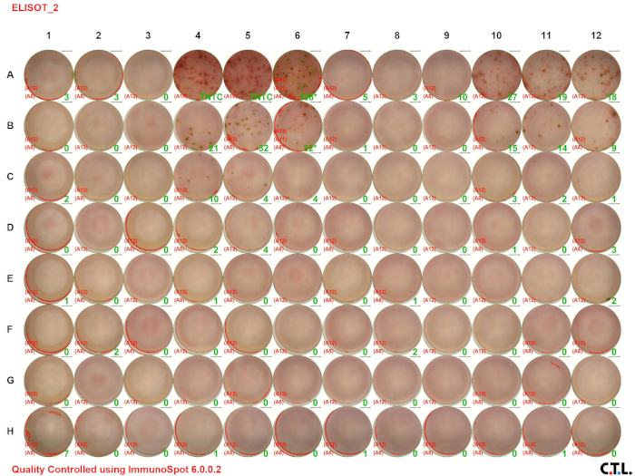 Figure 2A